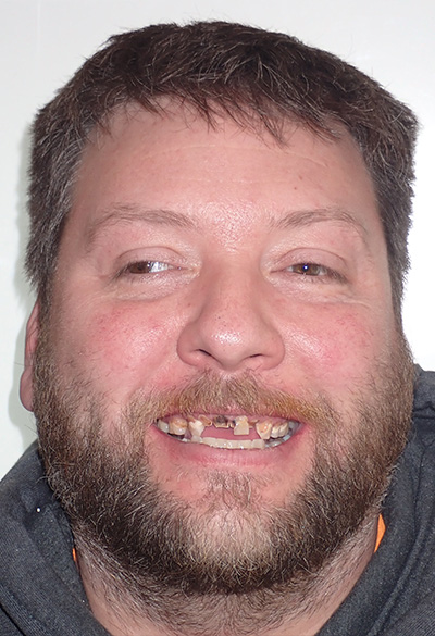 B&A-Face-Don-Before B&A-Face-Don-Before