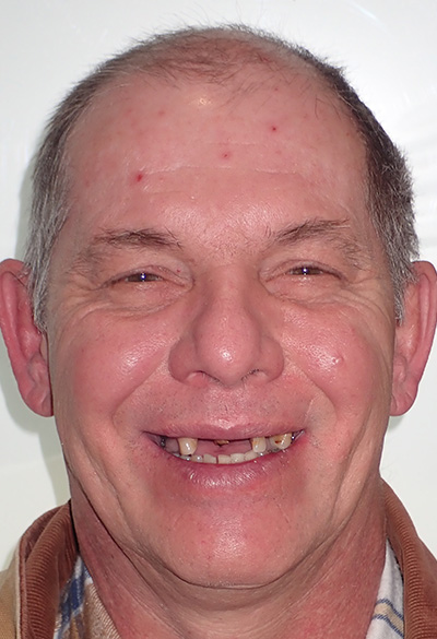 B&A-Face-Jeff-Before B&A-Face-Jeff-Before