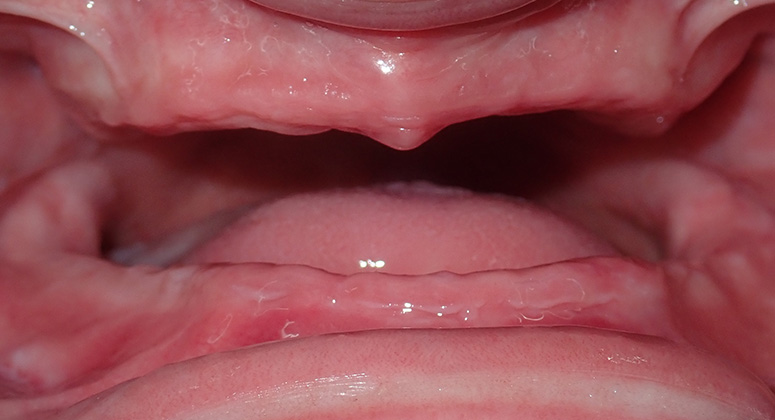B&A-Teeth-Amanda-Before B&A-Teeth-Amanda-Before