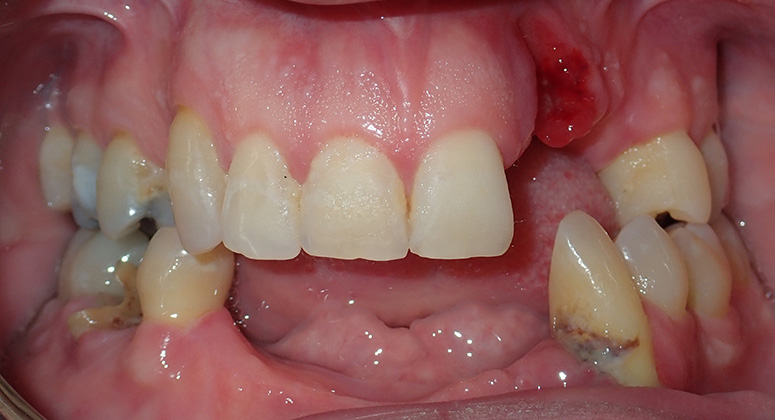 B&A-Teeth-Andrew-Before B&A-Teeth-Andrew-Before