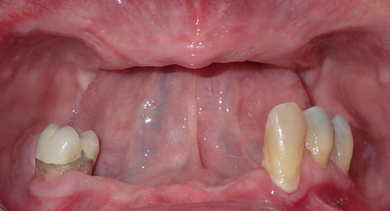 B&A-Teeth-Barb-Before B&A-Teeth-Barb-Before