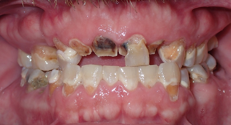 B&A-Teeth-Don-Before B&A-Teeth-Don-Before