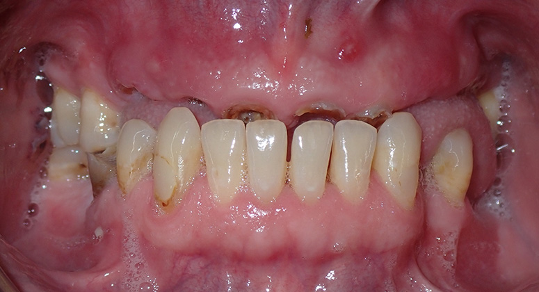B&A-Teeth-Ian-Before B&A-Teeth-Ian-Before