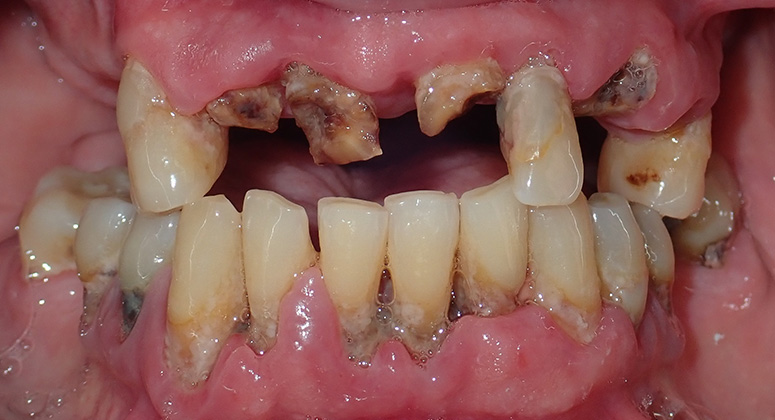 B&A-Teeth-Jeff-Before B&A-Teeth-Jeff-Before
