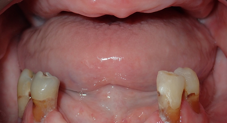 B&A-Teeth-Pat-Before B&A-Teeth-Pat-Before